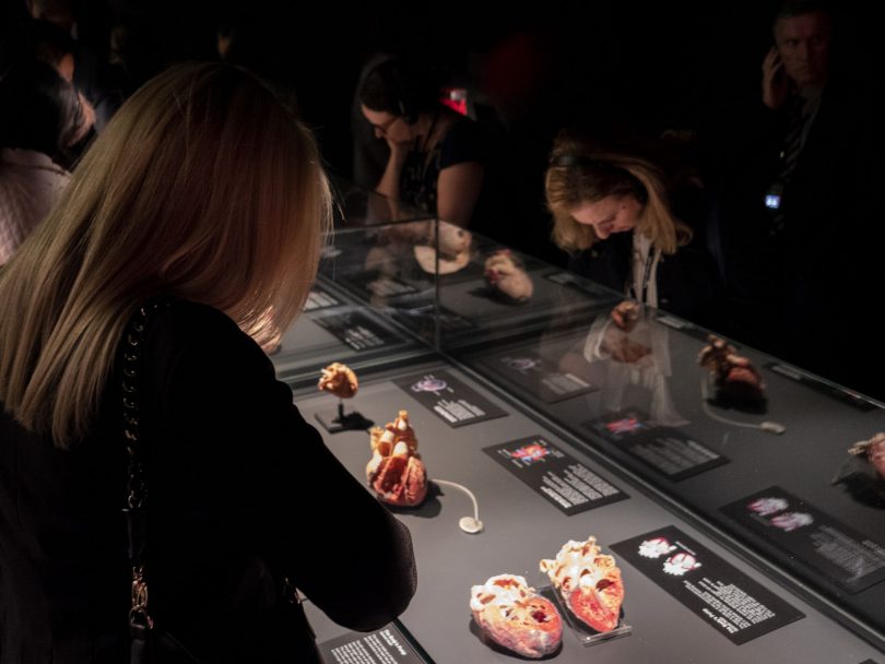 5 Brilliant Reasons to visit Body Worlds London's newest Museum